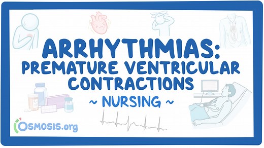 Arrhythmias - Premature ventricular contractions (PVCs): Nursing: Video & Causes | Osmosis