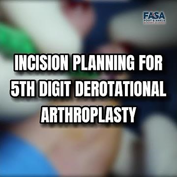 5th Toe Derotational Arthroplasty