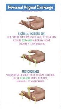 Abnormal Per Vaginal discharge Explained│Explained