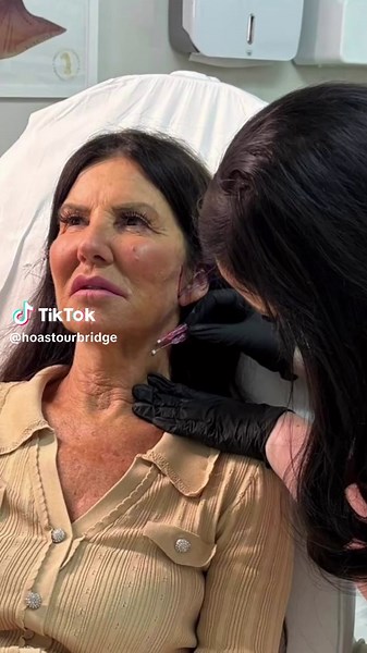 Revitalize Your Neck Area with PDO Threads and Skin Boosters