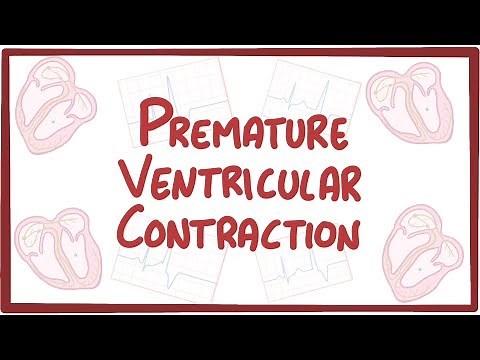 Premature Ventricular Contraction - causes, symptoms, diagnosis, treatment, pathology