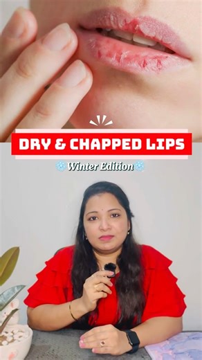 పగిలిన, పొడిబారిన lips💋? Creams for dry & cracked lips #lipcare #drylips #lips #skincare #telugu