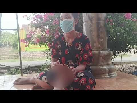 JIGGER Removal | JIGGER Diging | JIGGER Larvae Treatment on legs👣👣NN00228