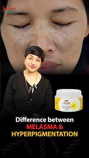 Understanding the Difference Between Hyperpigmentation and Melasma | Causes, Prevention, & Treatment