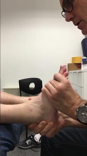 Ankle Fusion Patient 5 Months After Operation Showing Foot's Range of Motion