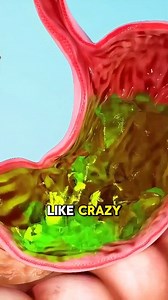 30K views · 494 reactions | How Digestive System Turns Food Into Poop (3D Animation) #digestive #system #digestivesystem #digestivehealth #digestiveenzymes #digestivesupport #food #poop #stomach #DigestiveWellness #medical3danimation #3dmedicalanimation | Medcare777 | Facebook