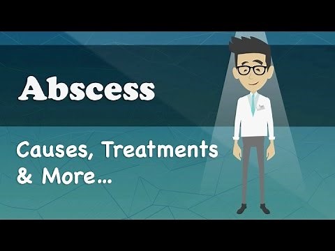 Abscess - Causes, Treatments & More…
