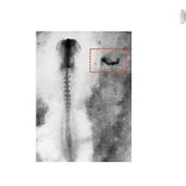Video: Assay for Neural Induction in the Chick Embryo