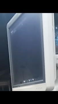 software update ultrasound machine
