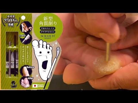 スクラッチスマートを使ってみました　Callus care tool made in Japan