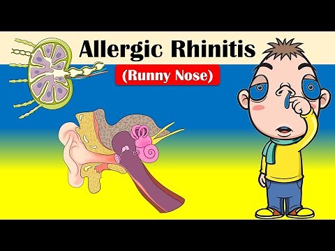 Allergic Rhinitis (Runny Nose) - Causes, Triggering Factors, Signs & Symptoms, And Treatment