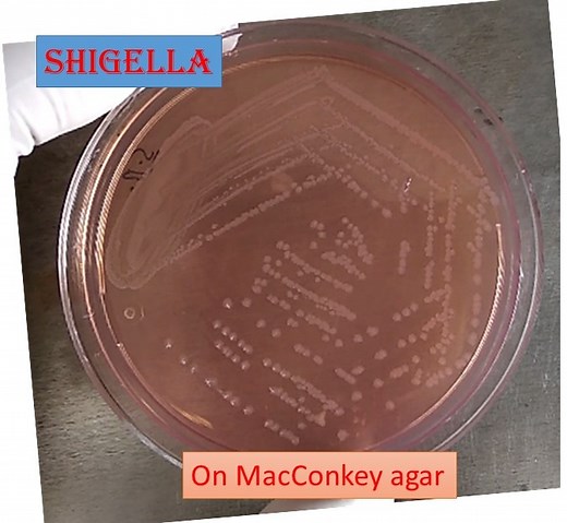 Shigella on MacConkey agar: Introduction, Morphology, Culture Character