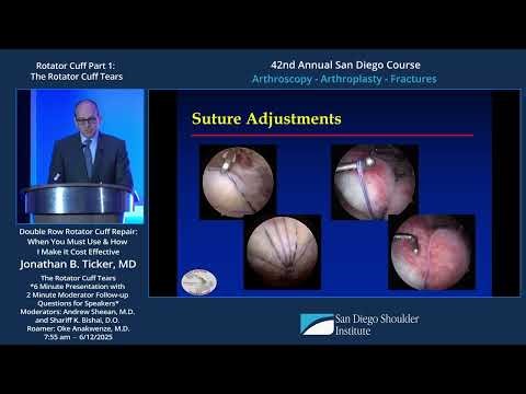 Rotator Cuff Tears: Double Row Repair, When to Use, How to Make it Cost-Effective