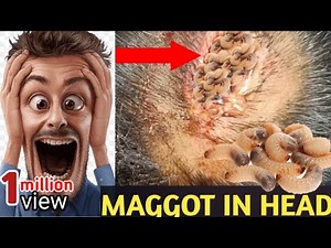 How Maggots Infect Human Wounds | Myiasis Explained