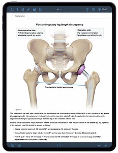 COMLEX-LEVEL2 Product Page