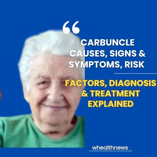 A carbuncle is a painful and serious skin infection that develops when multiple boils merge into one deep, inflamed area. Understanding the causes, symptoms, and risk factors can help you spot it early and prevent complications. Learn how carbuncles form, who is most at risk, how doctors diagnose them, and the most effective treatment options — from warm compresses to medical procedures and antibiotics. Staying informed helps protect your skin health and prevent infections from spreading. ✔️ #Ca