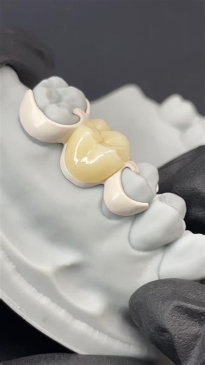 Want to get a price list,please contact my WhatsApp: 86-15393729102, our sale coworker will tell you more details, like brochure...#dentist#dentallab#teeth#denture #dentaltreatment #3Dprinter #Thefastestlaboratory #crowns #Dentalimplant #Zirconiacrown #PFM #CAD #CAM