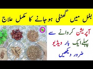 Armpit Lump Treatment - Under Arms Cyst Treatment At Home