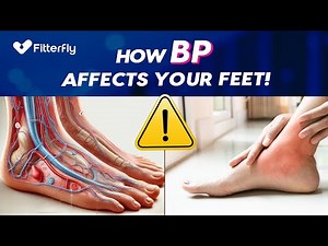 Why High Blood Pressure Causes Leg and Foot Swelling Explained!