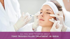 All You Need To Know About Tear Trough Filler Treatment In India – Richardson's Plastic Surgery Hospitals