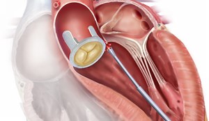A First in Medical Robotics