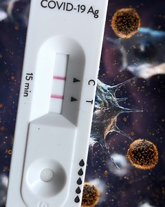 3.9K views · 792 reactions | A person who has been vaccinated against COVID-19 will have a slightly different immune response to the coronavirus than someone who was previously infected, researchers say. How long does immunity last—and is it all about antibodies? | NOVA l PBS | Facebook