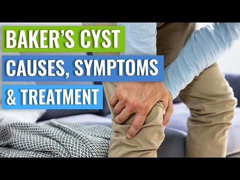 Baker's Cyst: How to Decide Whether You Need Surgery