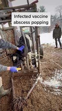 Satisfying Giant abscess/pimple popping.