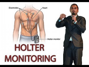 HOLTER MONITORING