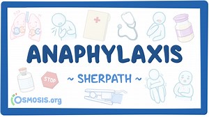 Video Case Study - Anaphylaxis: Video, Causes, & Meaning | Osmosis