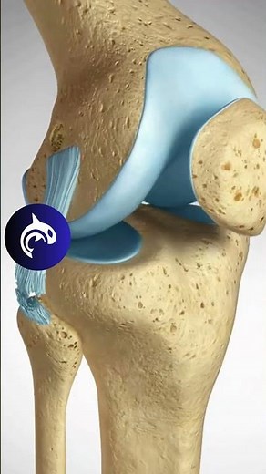 See an ACL LCL Repair of the Knee in 3D animation #4k #kneepain #kneeosteoarthritis