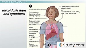 Intrinsic Causes of Restrictive Lung Disease