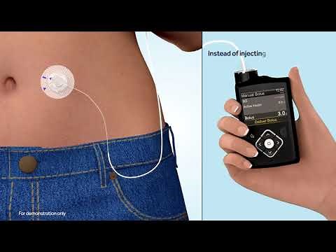 What is an insulin pump?