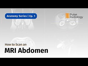 How to Scan an MRI Abdomen