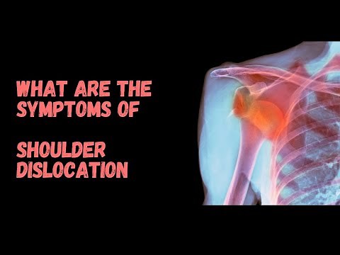 What are the symptoms of shoulder dislocation?