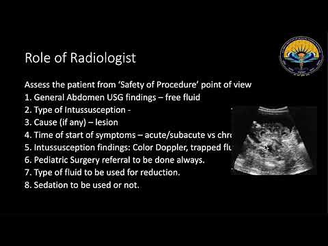 USG guided - Hydrostatic Reduction of Intussusception