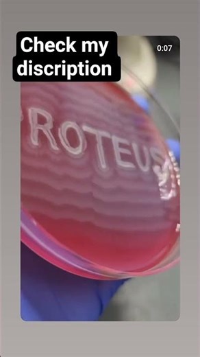 Swarming Growth of Proteus Bacteria on Nutrient Agar Plate | Microbiology video ko 🙏 subscribe