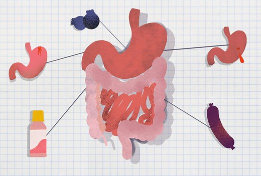 Why Is My Poop Black? What's Normal and When to Worry