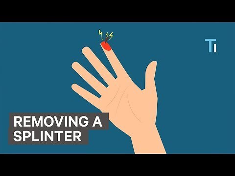 How To Remove A Splinter