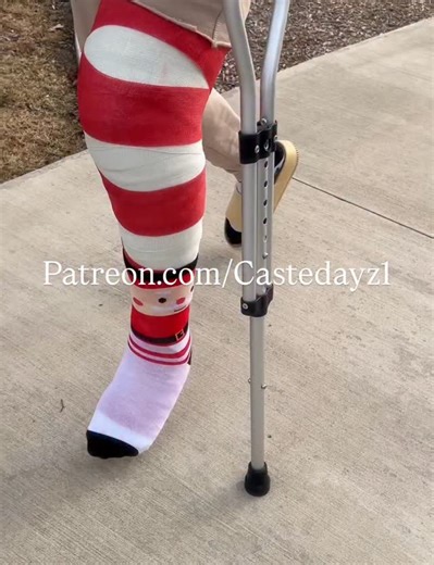 ✨Castedayz_1 ✨ on Instagram: "Happy Holidays #castedayz_1 #legcast #foryou #castedleg #crutching #longlegcast #fiberart #castcandy #crutches #castsock #cute #socks #socklover #cutesocks"
