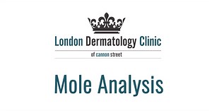 Mole Check | London Dermatology Clinic | Skin Specialists