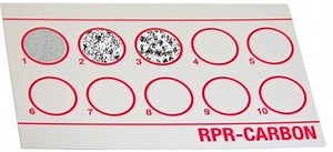 RPR Test: Principle, Procedure, Interpretations • Microbe Online