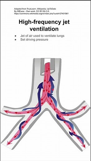 High-frequency jet ventilation