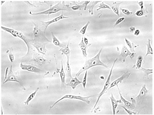 Mesenchymal cells or MSCs: definition, clinical potential, challenges - The Niche