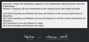 Assertion : After implantation, finger-like projections appear ... | Filo