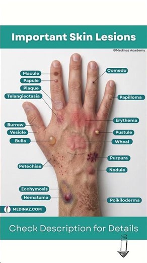 Important Skin Lesions You Should Know | Skin Diseases