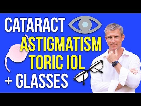 Cataract, astigmatism, toric IOL, glasses and IOL selection