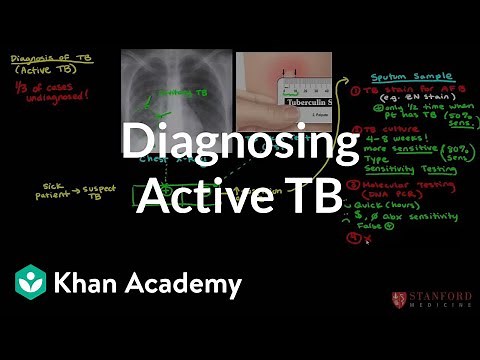 Diagnosing active TB | Infectious diseases | NCLEX-RN | Khan Academy