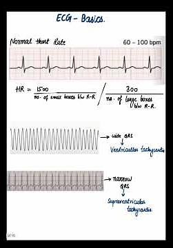 ECG Basics Explained | Easy ECG Interpretation for Beginners | Step-by-Step Guide