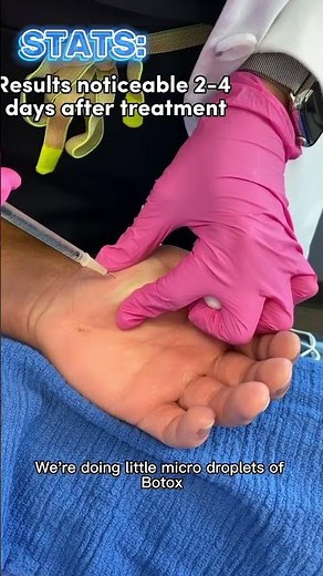 TREAT HYPERHIDROSIS WITH BOTOX